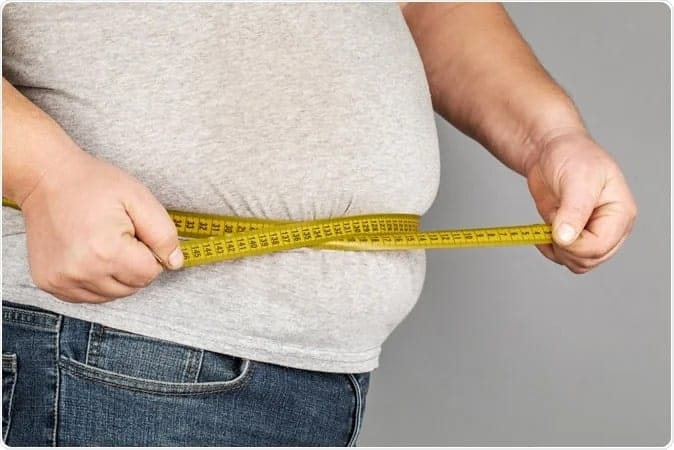 What to expect before and after weight loss surgery?